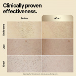 Braun IPL Silk Expert Pro 5 PL5382 IPL-apparat