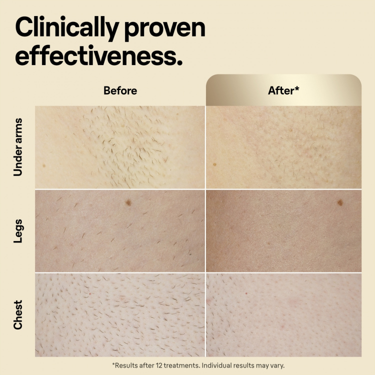 Braun IPL Silk Expert Pro 5 PL5382 IPL-apparat