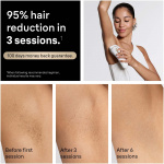 Braun IPL Silk·expert Pro 5, Hårborttagning Hemma, 2 huvuden, PL5221